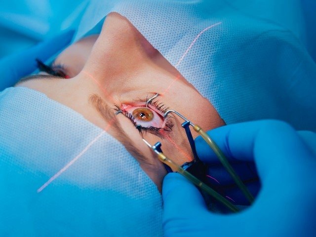 Cirugía de glaucoma